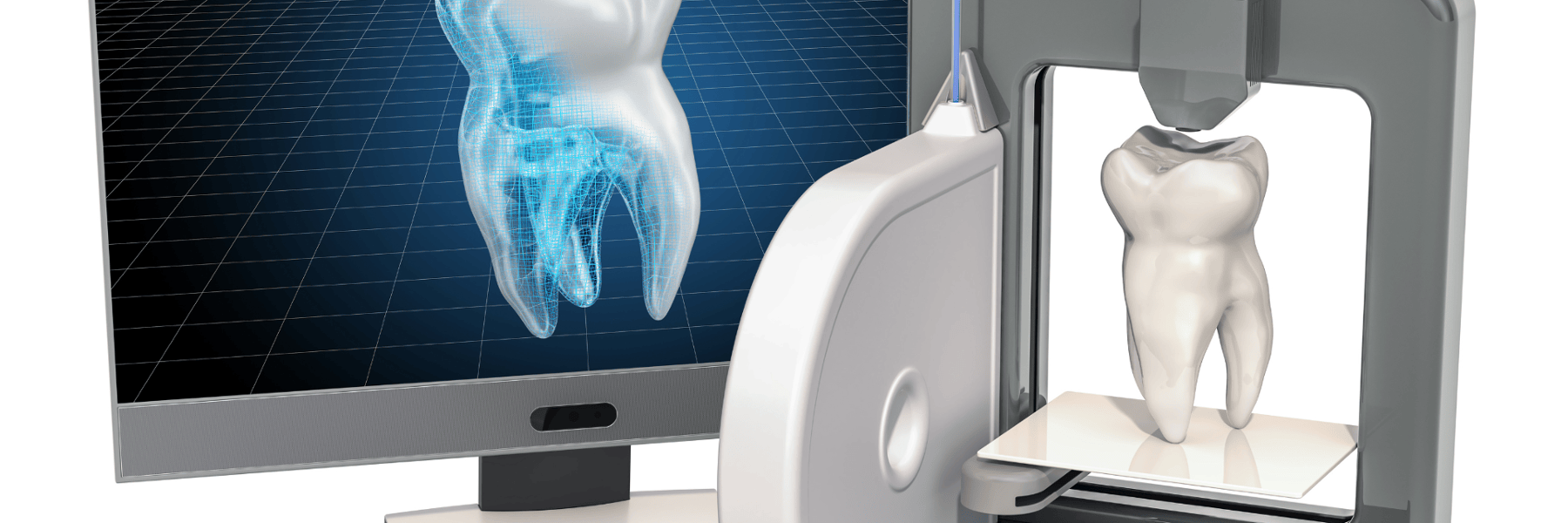 3D Printed Veneers | Dentist