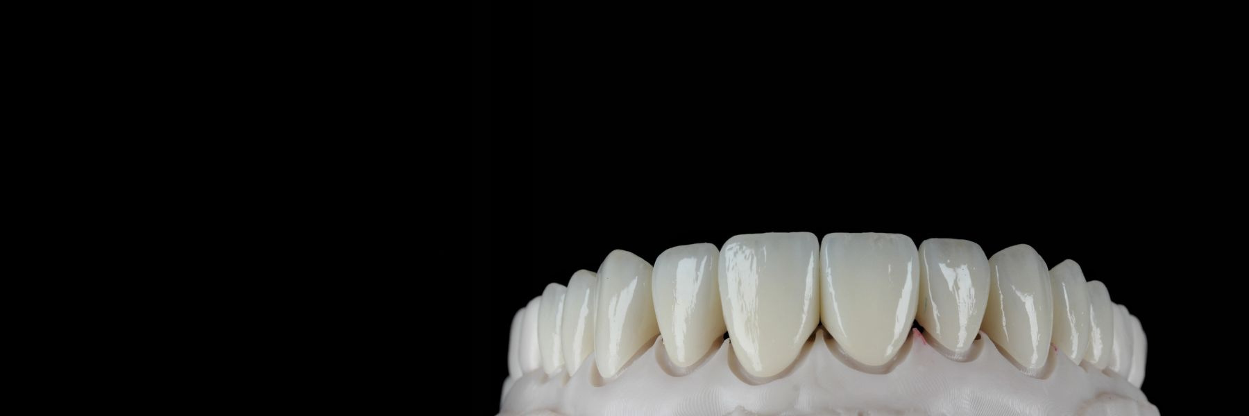 Full Mouth Rehabilitation | Dentist