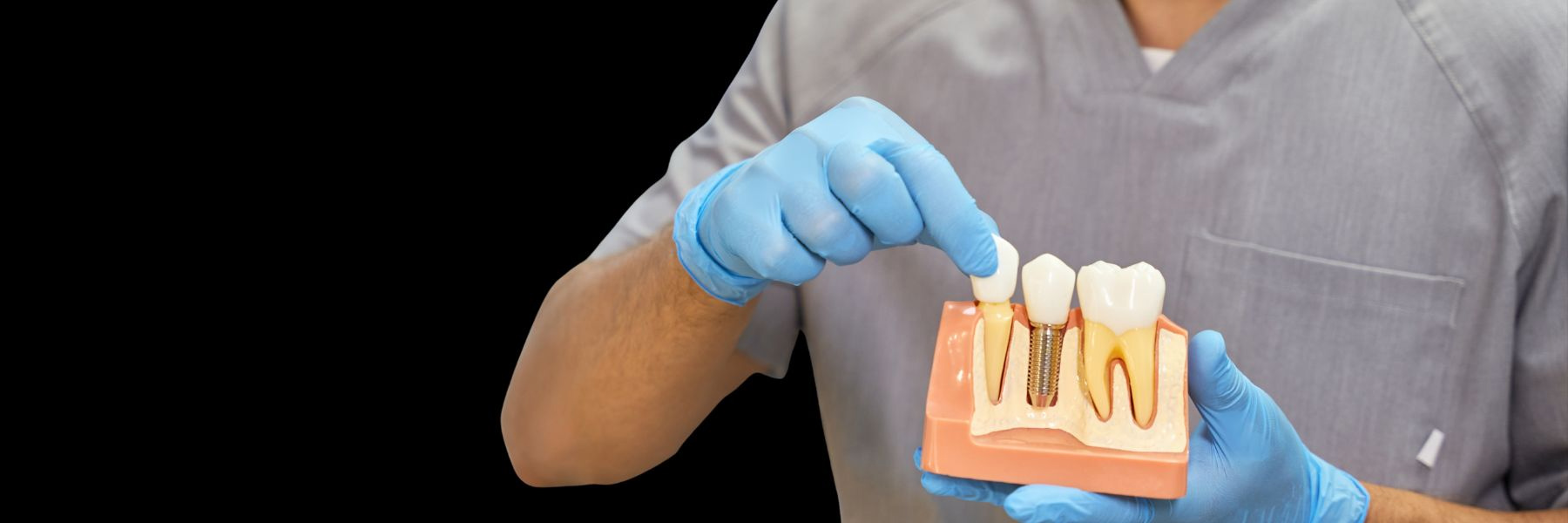 Implants and Restorations | Dentist