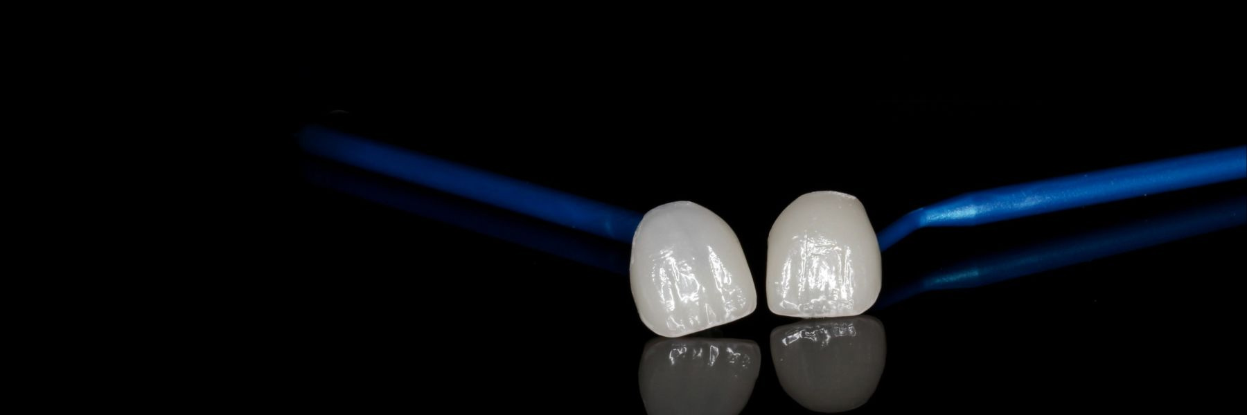 Porcelain Veneers | Dentist