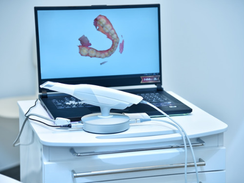 Intraoral Cameras