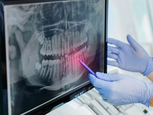 Digital X-Rays